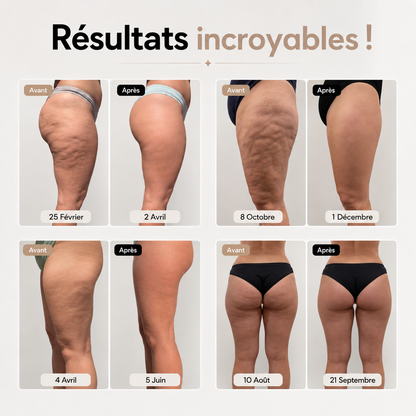 Le Sculpt — Anti-cellulite